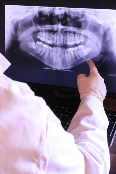 Best Emergency Denture Repair in Pitman, NJ